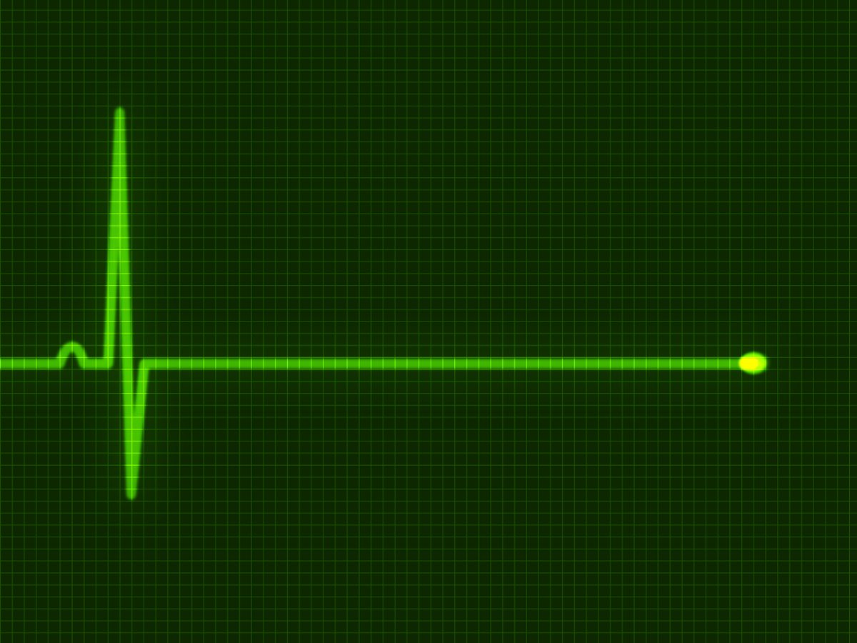 smrť, infakrt, mozog, EKG