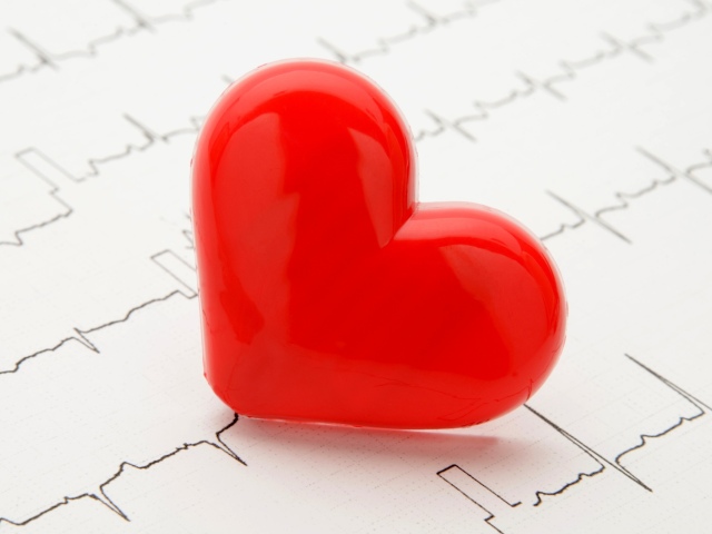 srdce, srdová arytmia, tep, prekvencia, EKG