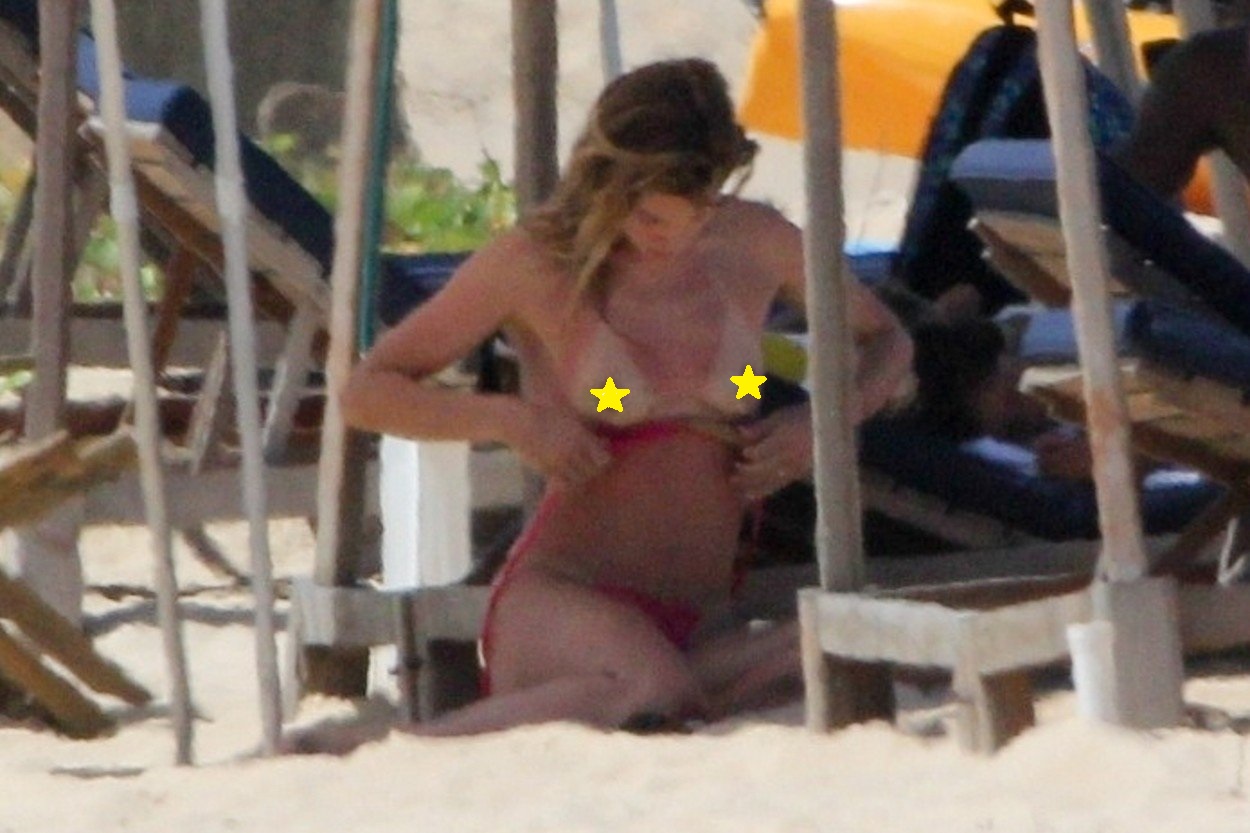Topmodelka Doutzen Kroes odhalila svoje poprsie na pláži v Brazílii. Prekvapila však najmä tým, že si ho spálila.