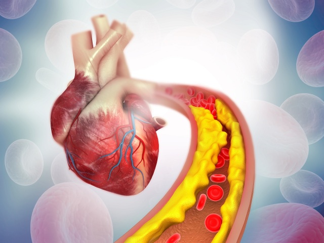 diabetes, srdce