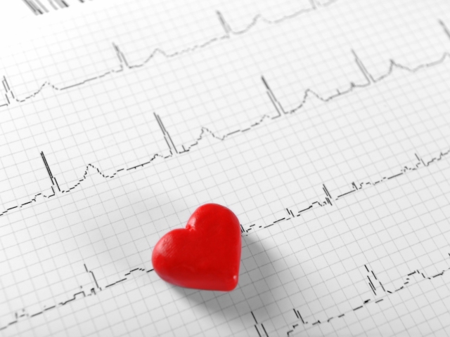 srdce, pulz, EKG