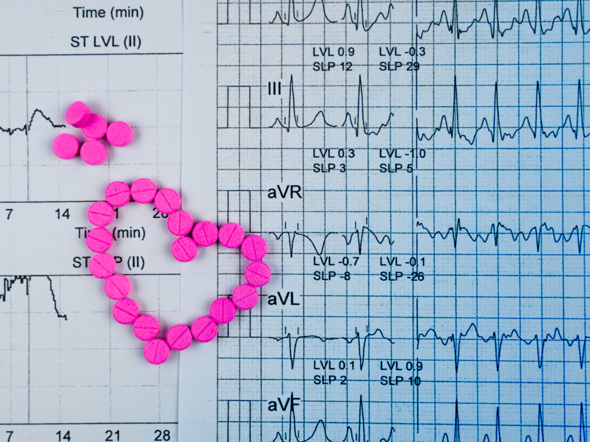 srdce, fibrilácia, EKG