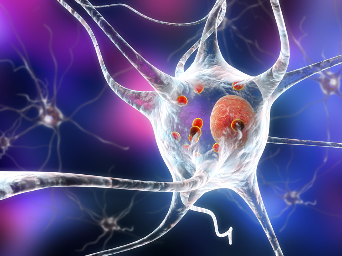 neurón, Parkinson
