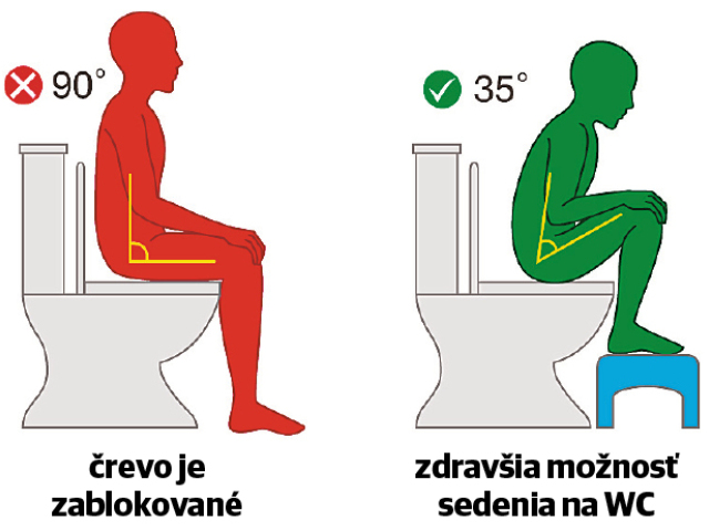Ilustračné foto. 
