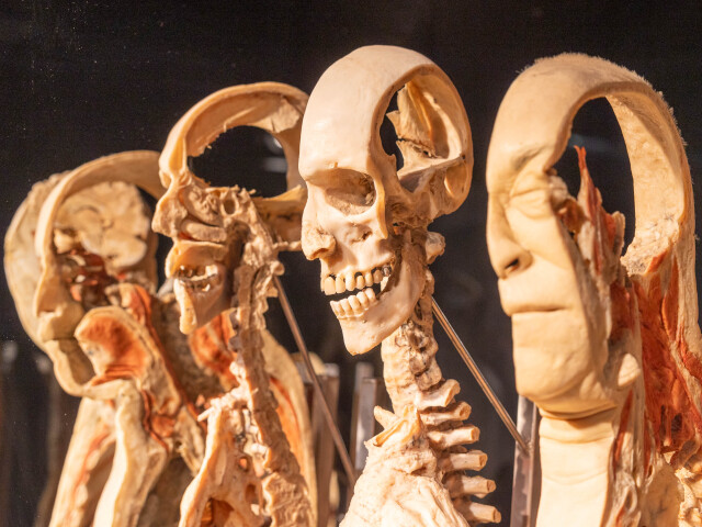 Plastinácia je postup zameraný na zachovanie ľudského tela na vzdelávacie účely, kde vodu a tuk v tkanive nahradí silikón.