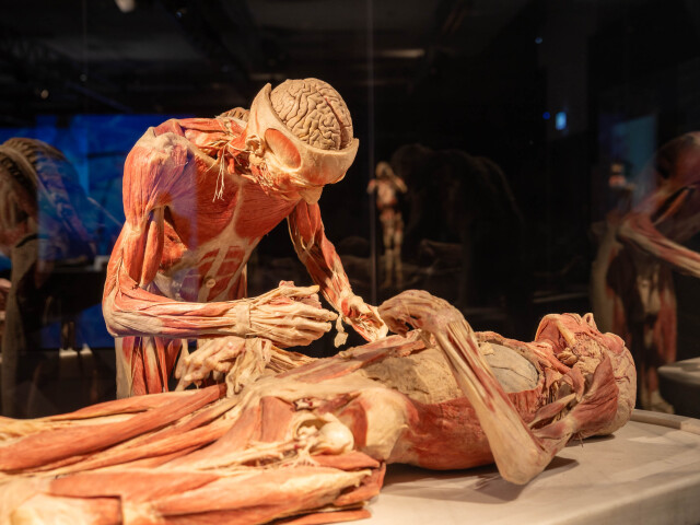 Inštitút plastinácie v nemeckom Heidelbergu má vyše 20-tisíc registrovaných záujemcov o posmrtnú plastináciu (do decembra 2022), pričom drvivá väčšina sú Nemci.
