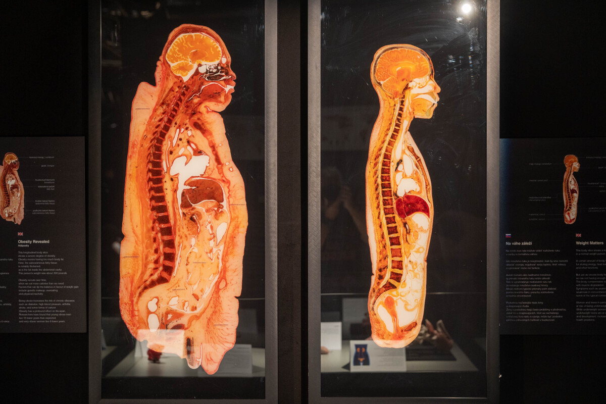 výstava Body Worlds, plastinácia,