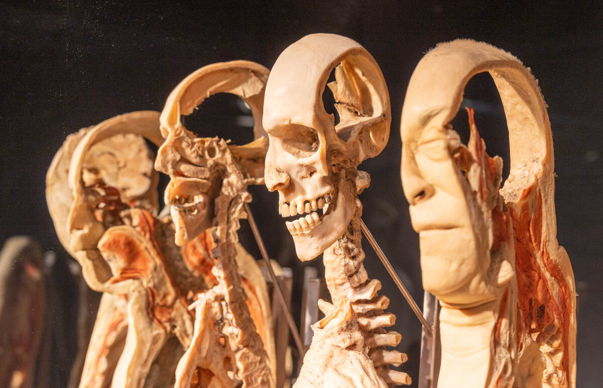 výstava Body Worlds, plastinácia