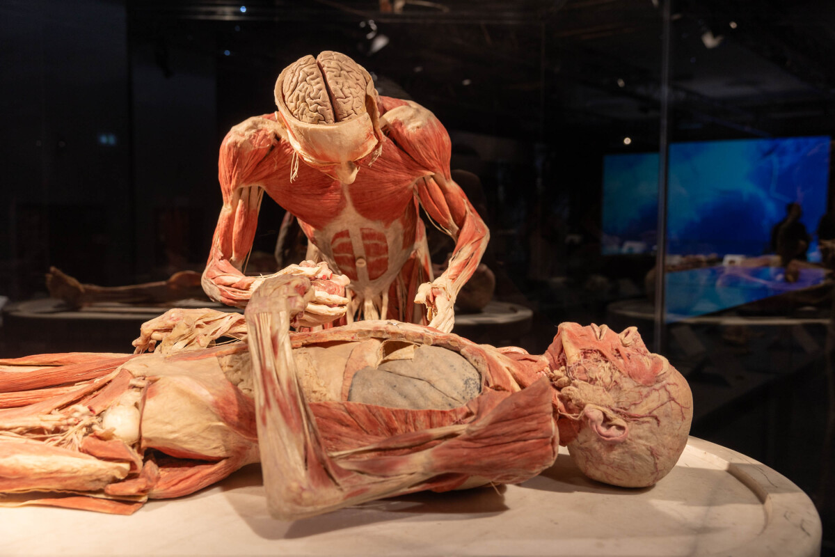 výstava Body Worlds, plastinácia