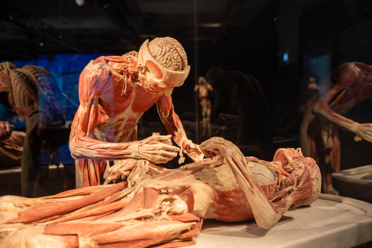 výstava Body Worlds, plastinácia
