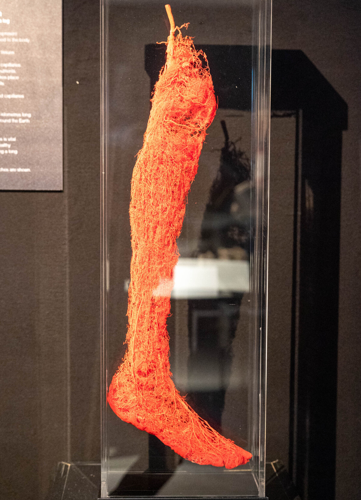 výstava Body Worlds, plastinácia