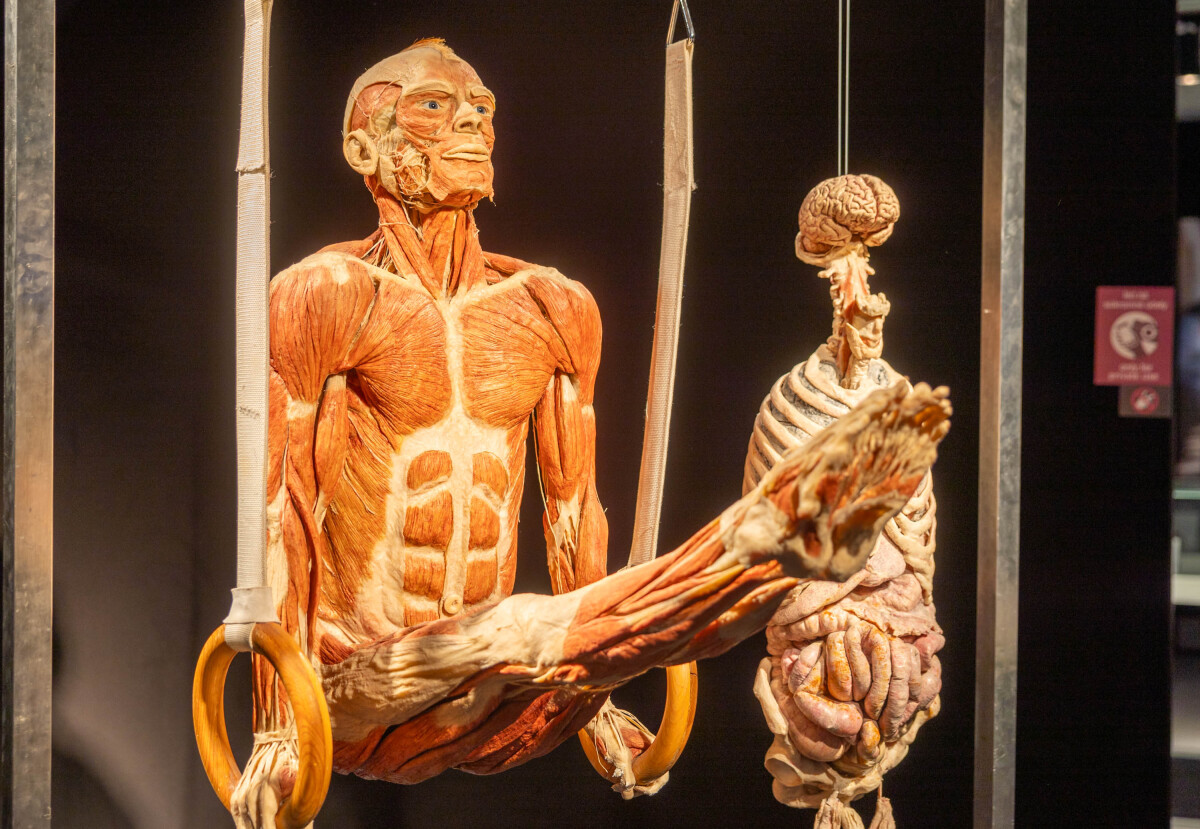 výstava Body Worlds, plastinácia