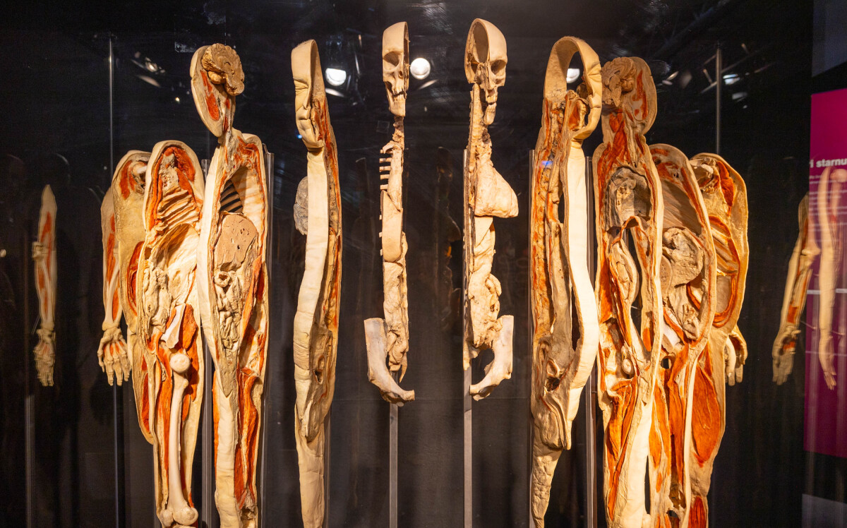 výstava Body Worlds, plastinácia