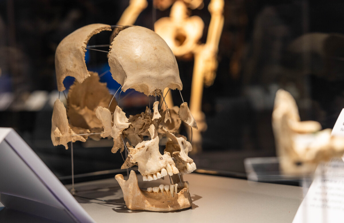 výstava Body Worlds, plastinácia