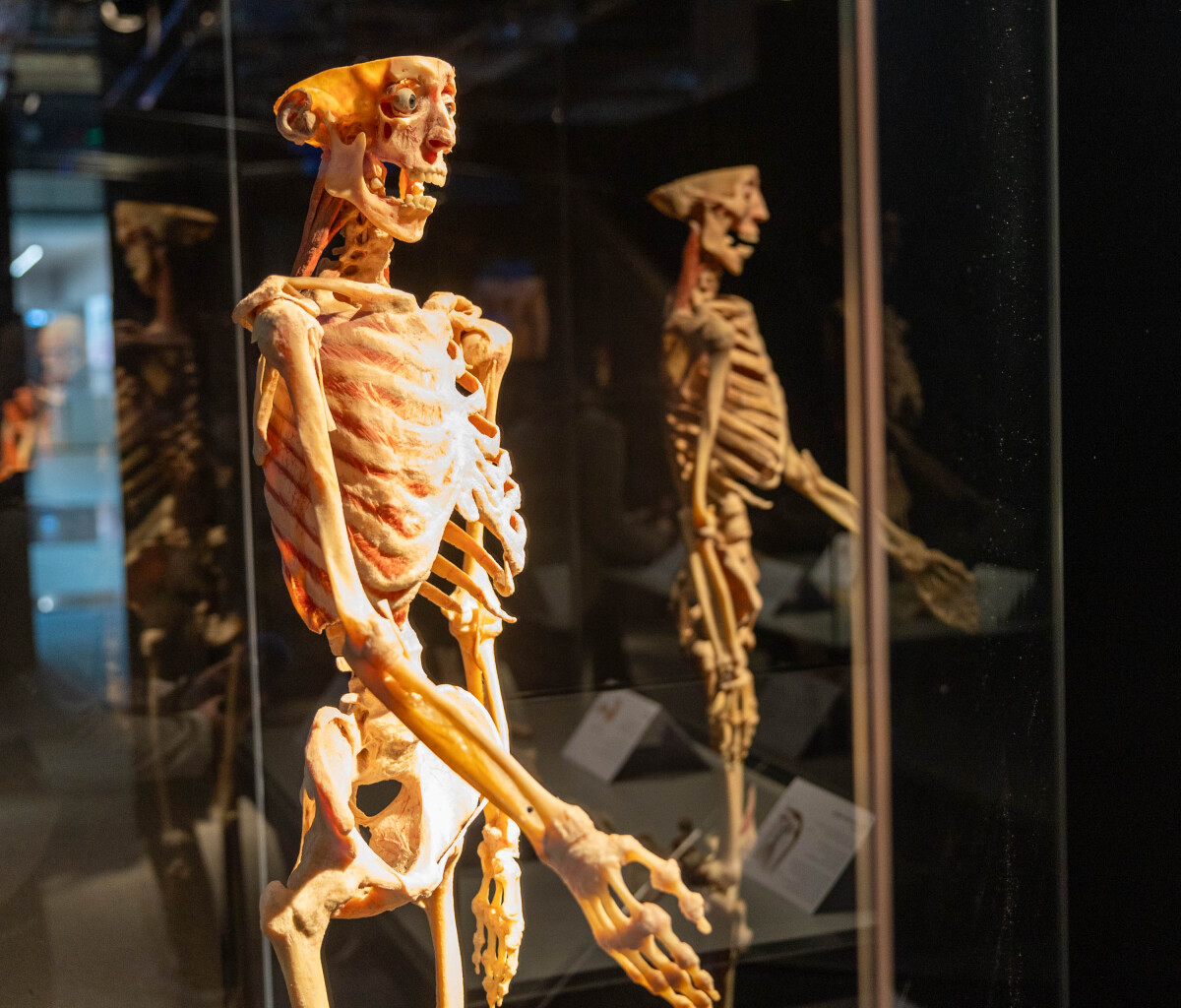 výstava Body Worlds, plastinácia