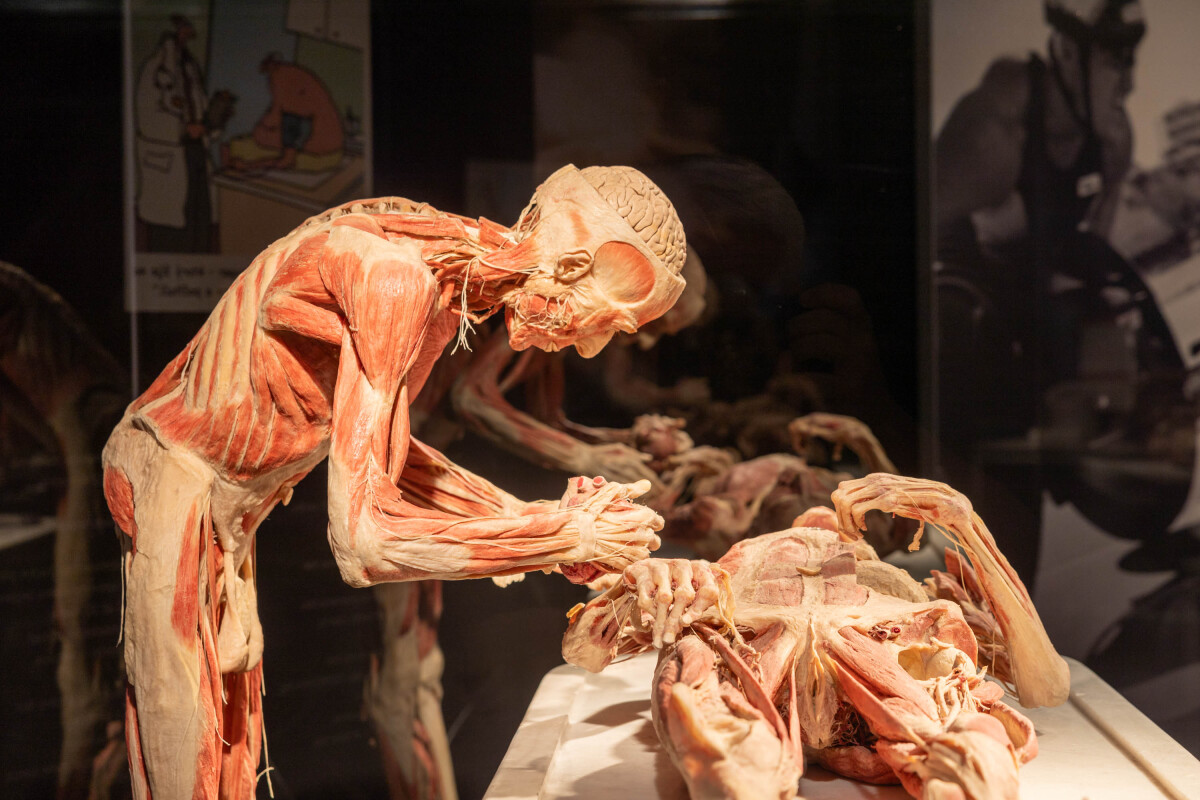 výstava Body Worlds, platinácia