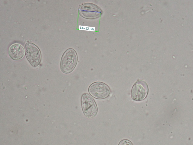 Giardia duodenalis pod mikroskopom.