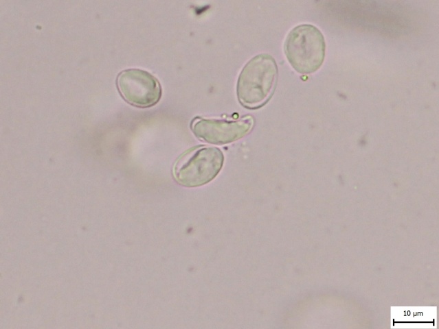 Giardia duodenalis 